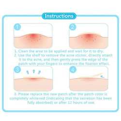 Acne Treatment Stickers Patch 